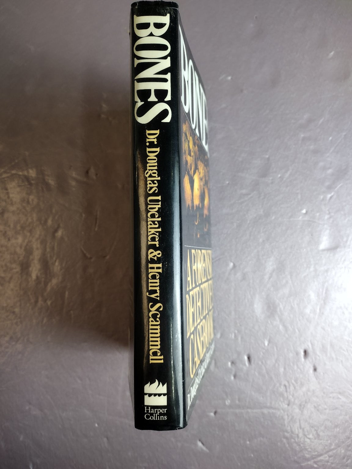 Bones: A Forensic Detective's Casebook Ubelaker Scammell 1994 Edward Burlingame